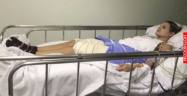 恐怖！巴西美臀皇后提臀手術竟腐蝕雙腿．．．！！！