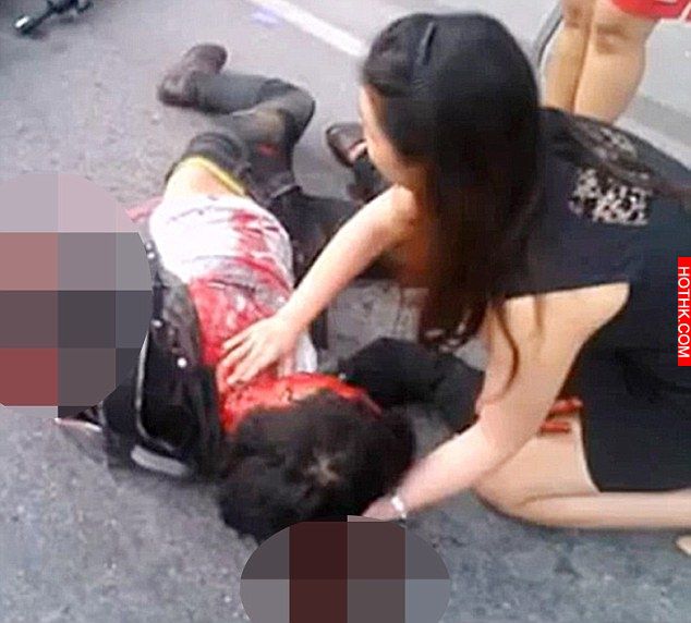 這名泰國的女醫師正好目睹一場車禍發生，她立刻搶救傷者，但路人發現她的膝蓋竟然跪在 ...