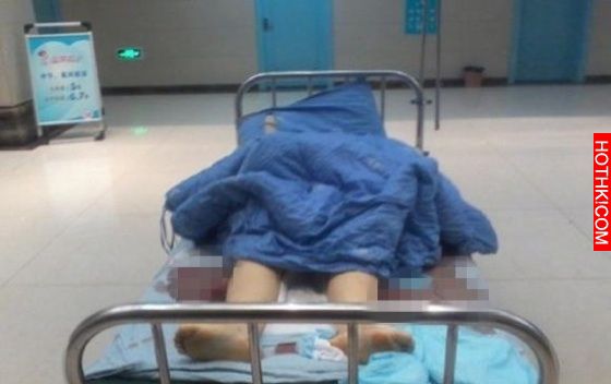 太誇張了！女子剖腹生產後肚子連續痛了七年，找到原因後所有人都嚇傻了... ... ... ...