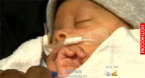 這孩子帶著別人沒有的東西出生，醫生差點慌了手腳！真是醫學奇蹟啊．．． ...