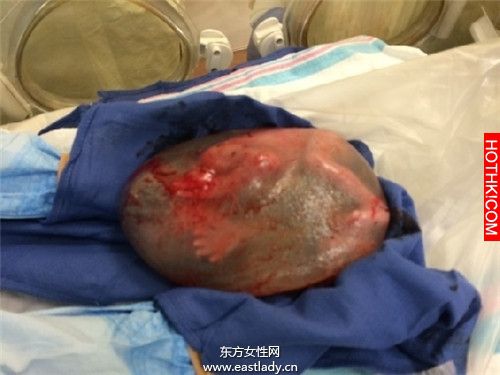 這孩子帶著別人沒有的東西出生，醫生差點慌了手腳！真是醫學奇蹟啊．．． ...
