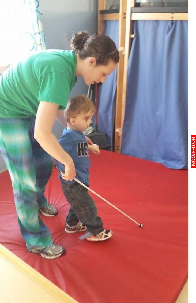 這對夫妻生下很多人覺得是受到詛咒的畸形寶寶，結果他卻是個「天使」 ...