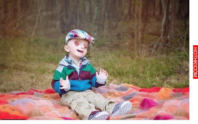 這對夫妻生下很多人覺得是受到詛咒的畸形寶寶，結果他卻是個「天使」 ...
