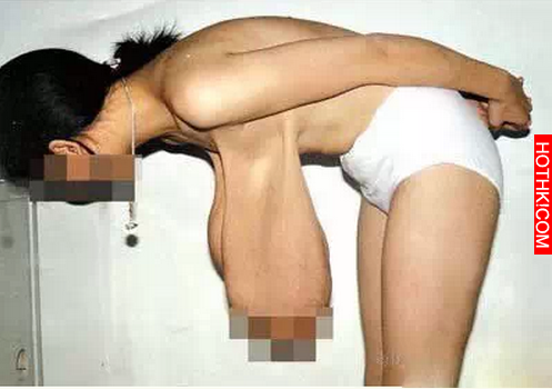 世界上乳房最多、腰最細、最醜、腿最長····的女人之最！震撼了!! ...
