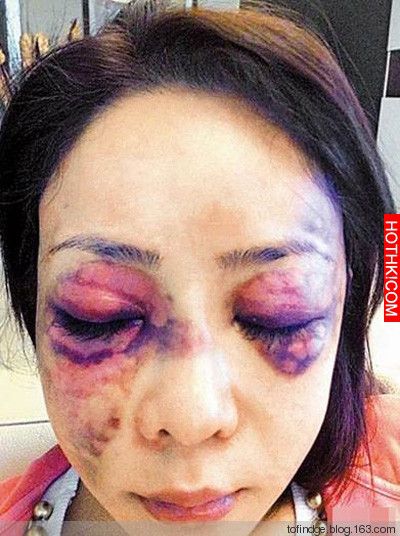 太痛！嫁入豪門卻慘遭家暴的女星．．．心疼阿！