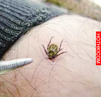 急轉！踏青掃墓小心！這種小蟲現在正活躍！已多次致人死亡！連狗狗都不放過... ...
