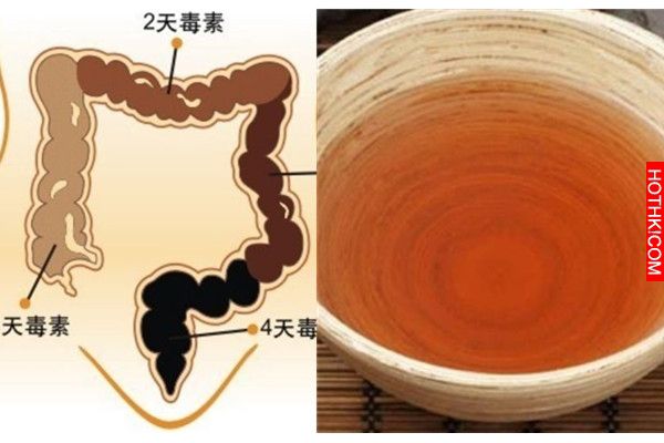 讚！蜂蜜加一樣東西喝了後，我真的就不再便祕了！每天都排得乾乾淨淨，小腹都消失了！ ...