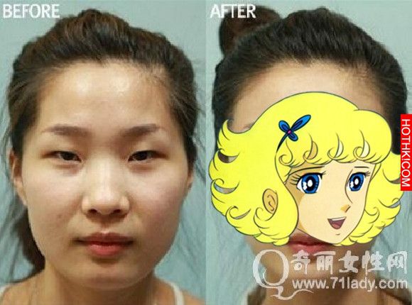亮瞎眼！中國人跑去韓國整容，醜女出國變仙女回來！家人以為遇到騙子...... ...