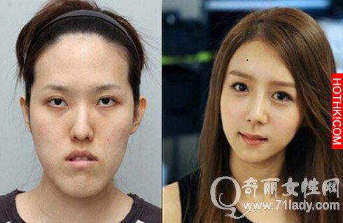 亮瞎眼！中國人跑去韓國整容，醜女出國變仙女回來！家人以為遇到騙子...... ...