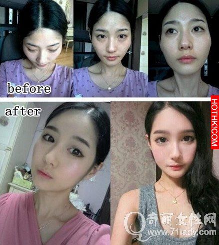 亮瞎眼！中國人跑去韓國整容，醜女出國變仙女回來！家人以為遇到騙子...... ...