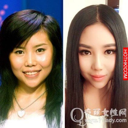 亮瞎眼！中國人跑去韓國整容，醜女出國變仙女回來！家人以為遇到騙子...... ...