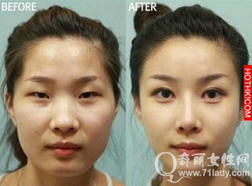 亮瞎眼！中國人跑去韓國整容，醜女出國變仙女回來！家人以為遇到騙子...... ...