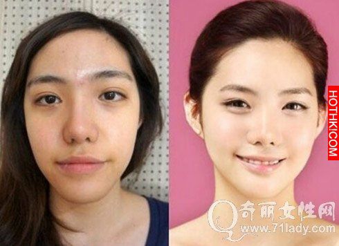 亮瞎眼！中國人跑去韓國整容，醜女出國變仙女回來！家人以為遇到騙子...... ...