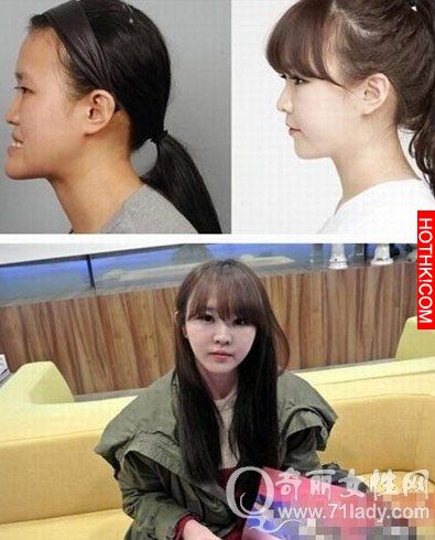 亮瞎眼！中國人跑去韓國整容，醜女出國變仙女回來！家人以為遇到騙子...... ...