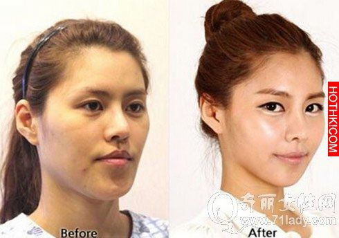 亮瞎眼！中國人跑去韓國整容，醜女出國變仙女回來！家人以為遇到騙子...... ...