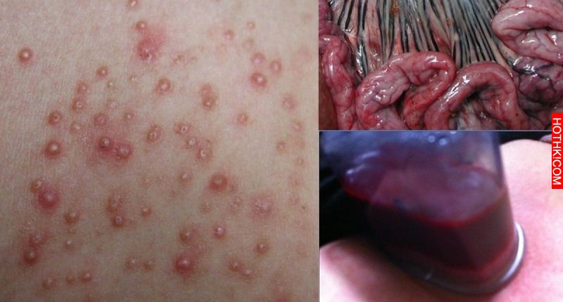 知道嗎？11種體內毒素你應該每天清！照著做能防止病變、青春永駐、百病不生！真的實用 ...