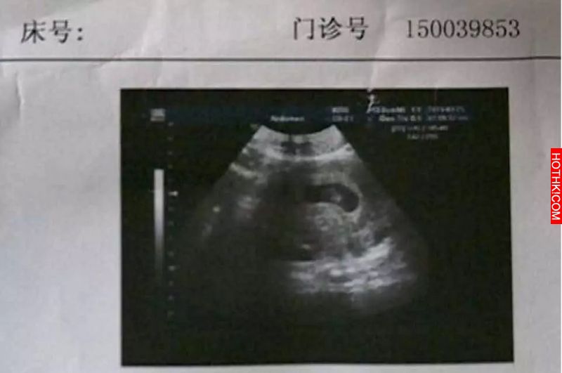 16歲少女5次懷孕，4次墮胎！男友竟然對她說‧‧‧‧‧‧‧