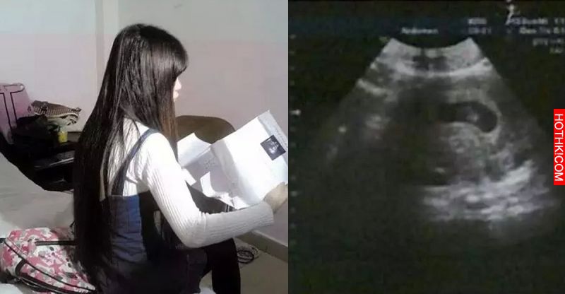 16歲少女5次懷孕，4次墮胎！男友竟然對她說‧‧‧‧‧‧‧