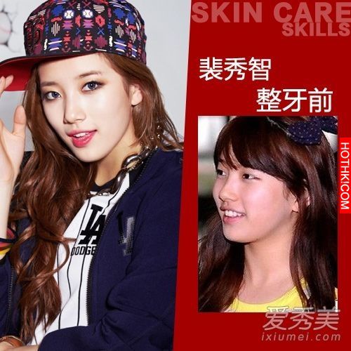 曝光！裴秀智 Baby 楊冪 整牙前後容貌變化驚人！讓人不敢直視... ...