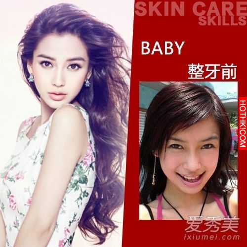 曝光！裴秀智 Baby 楊冪 整牙前後容貌變化驚人！讓人不敢直視... ...