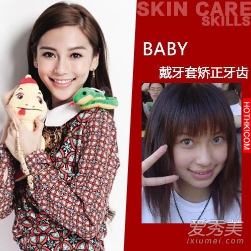曝光！裴秀智 Baby 楊冪 整牙前後容貌變化驚人！讓人不敢直視... ...