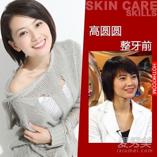 曝光！裴秀智 Baby 楊冪 整牙前後容貌變化驚人！讓人不敢直視... ...