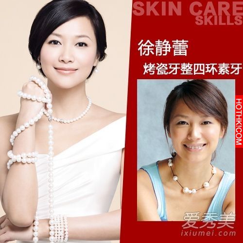 曝光！裴秀智 Baby 楊冪 整牙前後容貌變化驚人！讓人不敢直視... ...