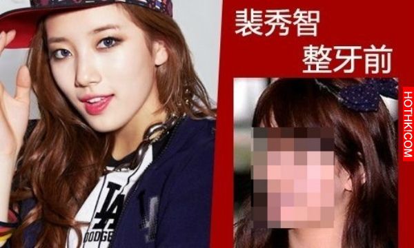 曝光！裴秀智 Baby 楊冪 整牙前後容貌變化驚人！讓人不敢直視... ...