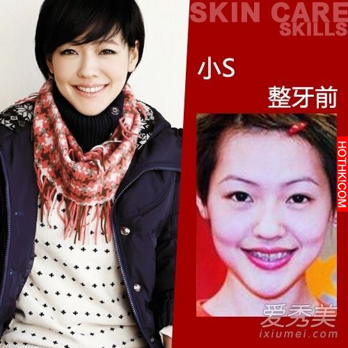 曝光！裴秀智 Baby 楊冪 整牙前後容貌變化驚人！讓人不敢直視... ...