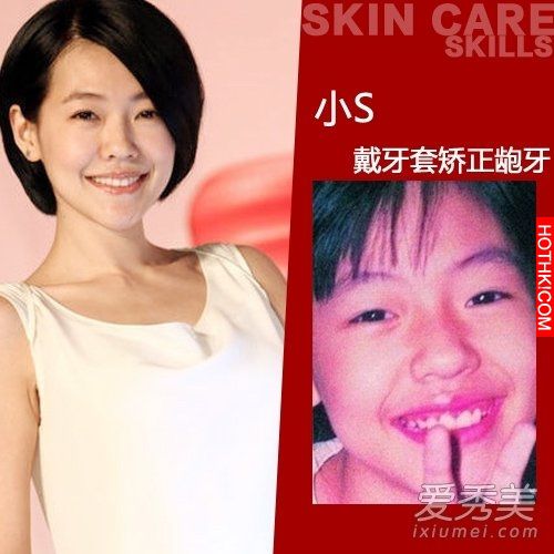 曝光！裴秀智 Baby 楊冪 整牙前後容貌變化驚人！讓人不敢直視... ...