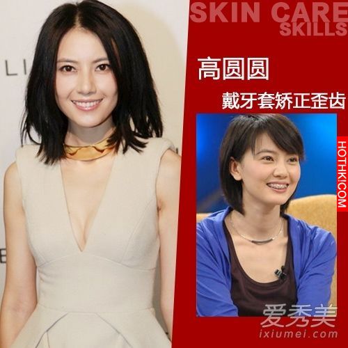 曝光！裴秀智 Baby 楊冪 整牙前後容貌變化驚人！讓人不敢直視... ...