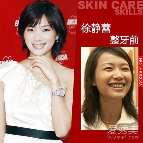 曝光！裴秀智 Baby 楊冪 整牙前後容貌變化驚人！讓人不敢直視... ...