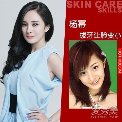 曝光！裴秀智 Baby 楊冪 整牙前後容貌變化驚人！讓人不敢直視... ...