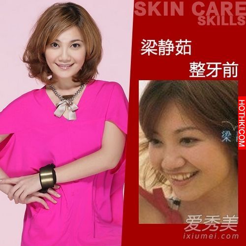 曝光！裴秀智 Baby 楊冪 整牙前後容貌變化驚人！讓人不敢直視... ...