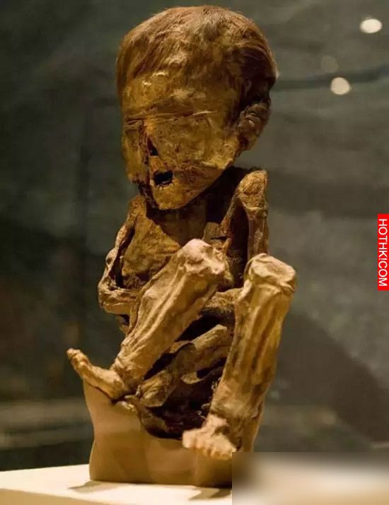 震驚！八旬老太太懷孕46年後產下一個.....，太可怕了...