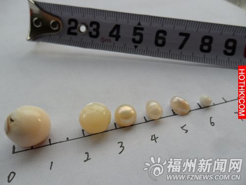 女子將1顆珍珠放糯米中，9年竟“生”出5顆珍珠