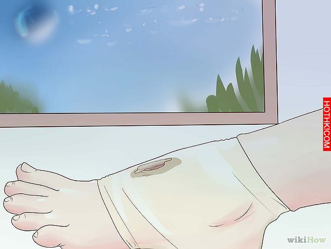 Get Rid of a Scab Step 4.jpg