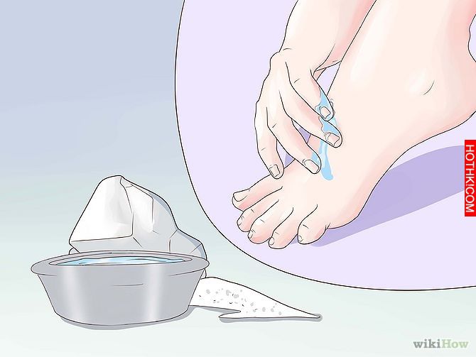 Get Rid of a Scab Step 13.jpg