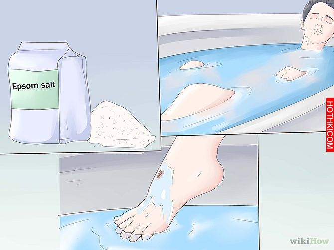 Get Rid of a Scab Step 9.jpg