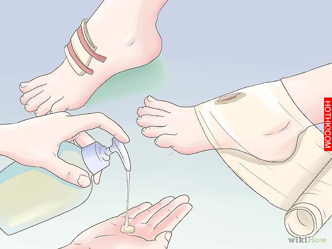 Get Rid of a Scab Step 5.jpg