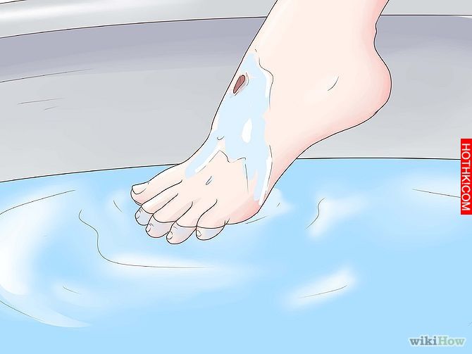 Get Rid of a Scab Step 8.jpg