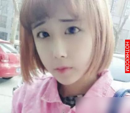 15歲少女為了愛情把自己整容的不成人形...網友嘆簡直是蛇妖...！ ...