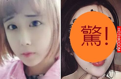 15歲少女為了愛情把自己整容的不成人形...網友嘆簡直是蛇妖...！ ...