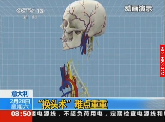 人類首度進行換頭手術！需花36小時，過程生不如死...
