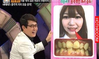 十年不刷牙的韓國正妹，張開牙後讓所有男人崩潰阿......