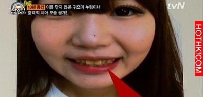 十年不刷牙的韓國正妹，張開牙後讓所有男人崩潰阿......