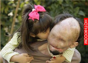 沒有臉的爸爸，他受傷的原因讓女兒覺得他是天使