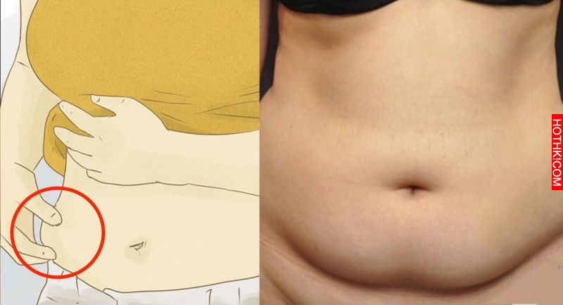 好恐怖！「宿便」不清竟會累積成「大腸癌」！自我檢查宿便只需要一個動作...！還好我 ...