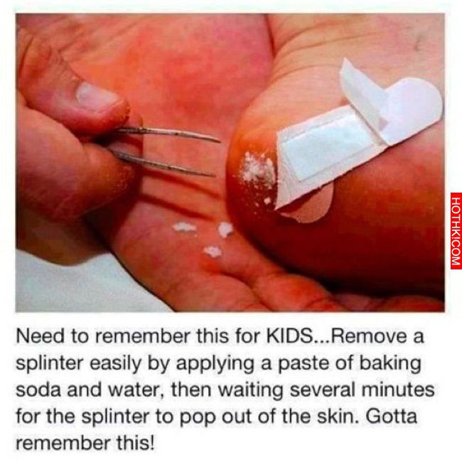 Use this method when removing splinters.
