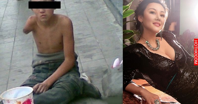 這個女孩一年四季都穿著厚重外套，就算太陽再大也不肯脫下。某天她拉開拉鍊的那一刻， ...